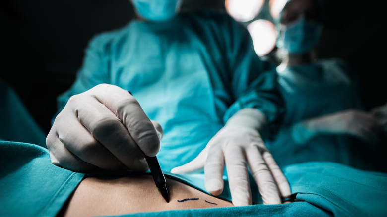 surgeon operating on patient