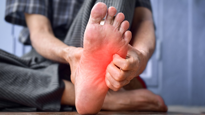 A man holds his foot after a sting